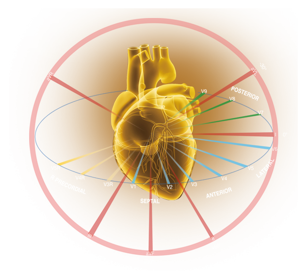 EDAN SE-18 18-Lead ECG Workstation - Image 5