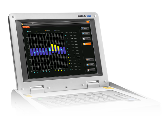 EDAN SE-18 18-Lead ECG Workstation