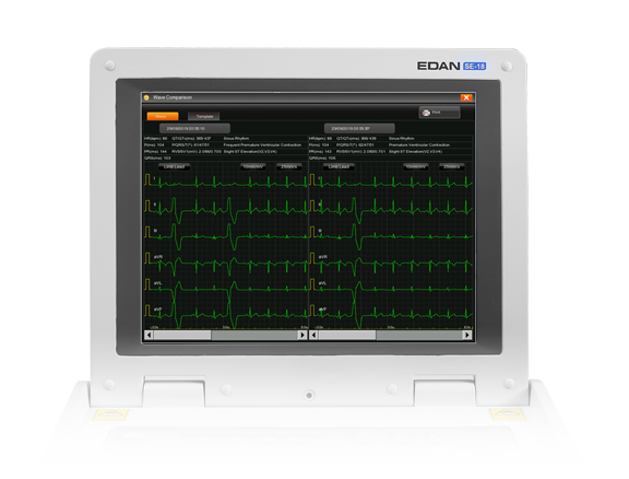 EDAN SE-18 18-Lead ECG Workstation - Image 3