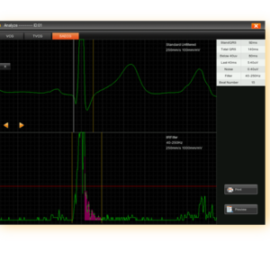 EDAN SE-18 18-Lead ECG Workstation