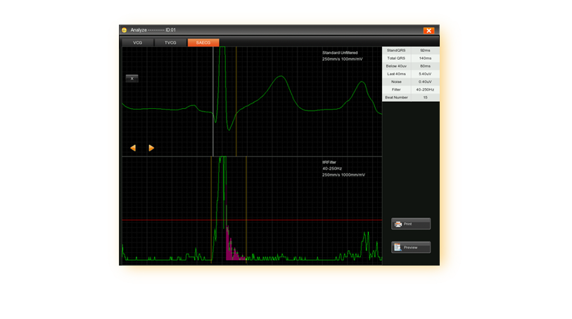 EDAN SE-18 18-Lead ECG Workstation - Image 6