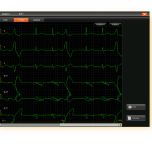 EDAN SE-18 18-Lead ECG Workstation