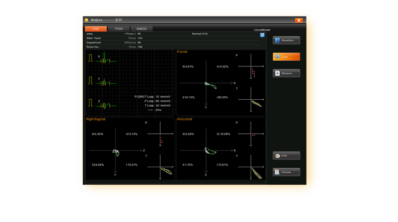 EDAN SE-18 18-Lead ECG Workstation - Image 4