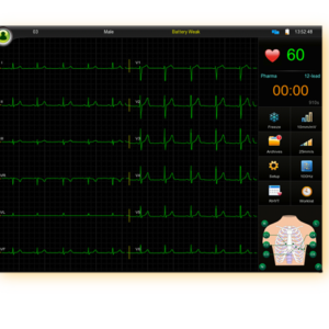 EDAN SE-18 18-Lead ECG Workstation