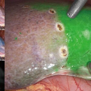 UX7 Series Endoscope Camera System (4K, NIR Fluorescence & 3D)
