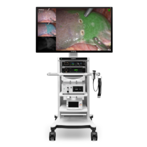 UX7 Series Endoscope Camera System (4K, NIR Fluorescence & 3D)