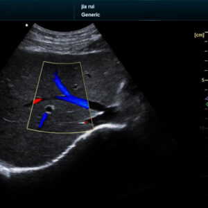 Yonker NEW Premium Diagnostic Ultrasound System Revo T2