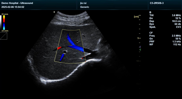 Yonker NEW Premium Diagnostic Ultrasound System Revo T2 14 Yonker NEW Premium Diagnostic Ultrasound System Revo T2 - Image 14