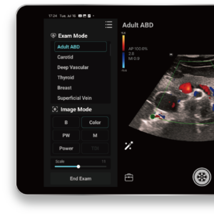 TE Air e5M Wireless Handheld Ultrasound System