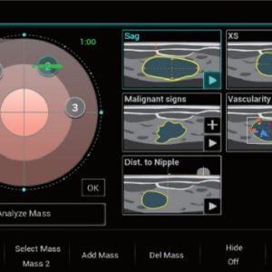Resona I9 - Diagnostic Ultrasound System
