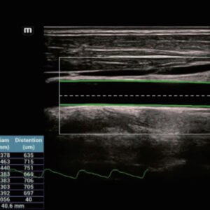 Resona I9 - Diagnostic Ultrasound System