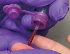 Essenlix Capillary Collection Tubes