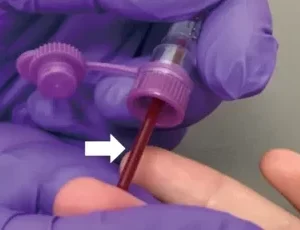 Essenlix Capillary Collection Tubes