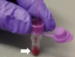 Essenlix Capillary Collection Tubes