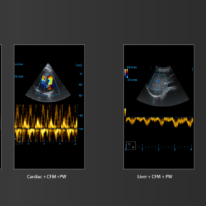 Yonker Aura Series Wireless&Handheld Color Ultrasound System