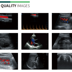 Yonker wireless Handheld WiFi color doppler ultrasound