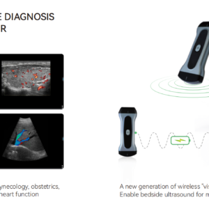 Yonker wireless Handheld WiFi color doppler ultrasound