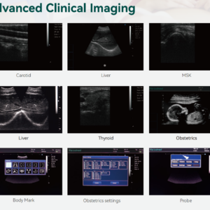 Yonker Black and white Digital Diagnostic Ultrasound System PU-DL121A
