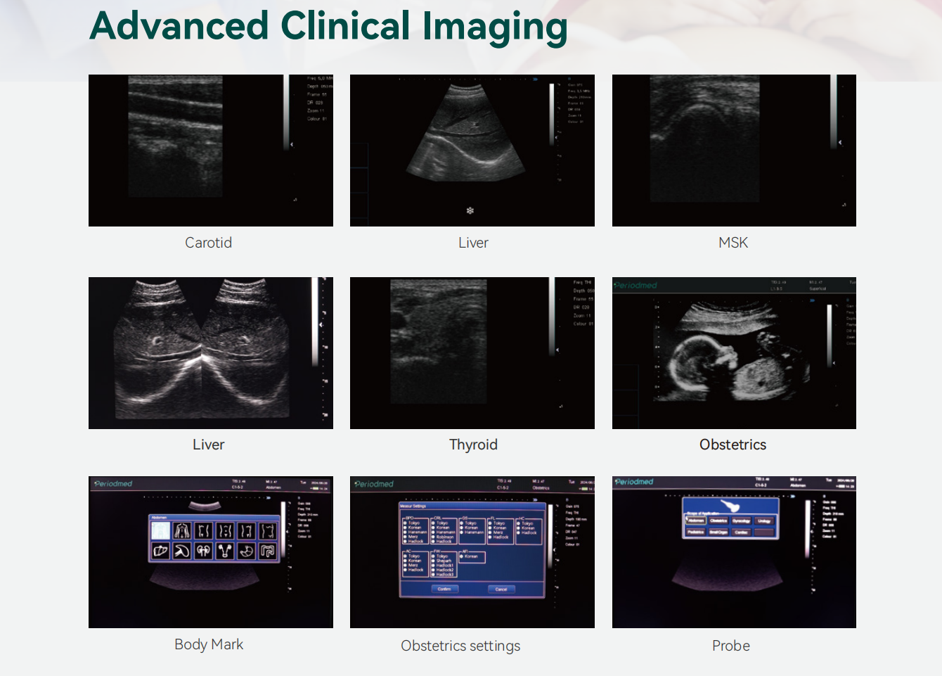 Yonker Black and white Digital Diagnostic Ultrasound System PU-DL121A 8 Yonker Black and white Digital Diagnostic Ultrasound System PU-DL121A - Image 8