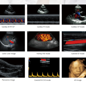 Yonker New Yonker Cheap Portable Color Doppler Ultrasound Machine PU-L151A