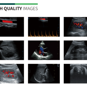 Yonker Pediatric Physical Exam Handheld Ultrasound Device