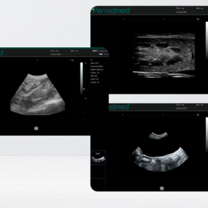 Yonker Veterinary Ultrasound Portable Color Doppler Ultrasound Machine PU-VP081A