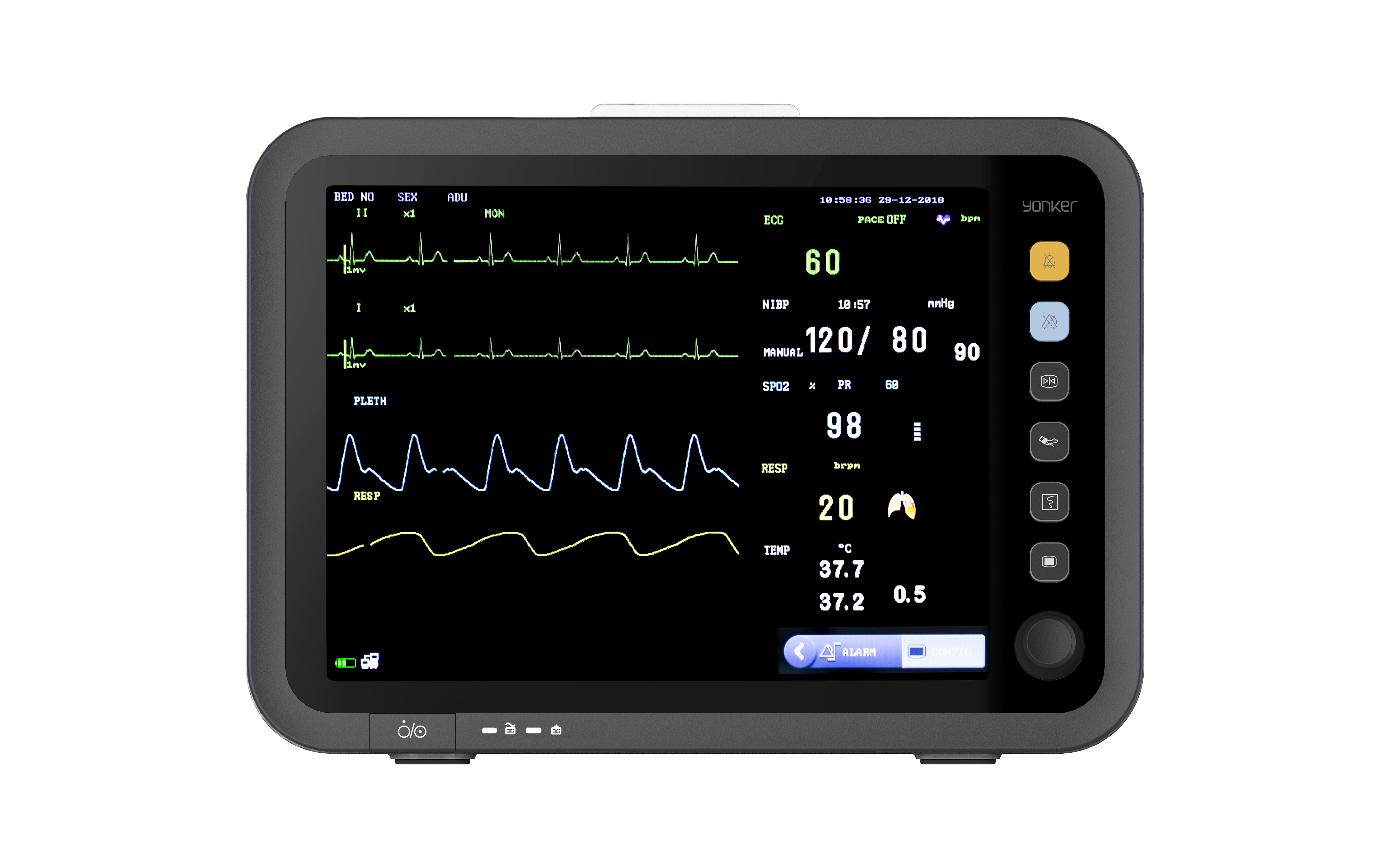 Yonker YK-8000C Patient Bedside Monitor 6 Yonker YK-8000C Patient Bedside Monitor - Image 6