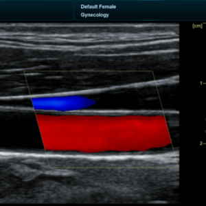Yonker NEW Premium Diagnostic Ultrasound System Revo T2