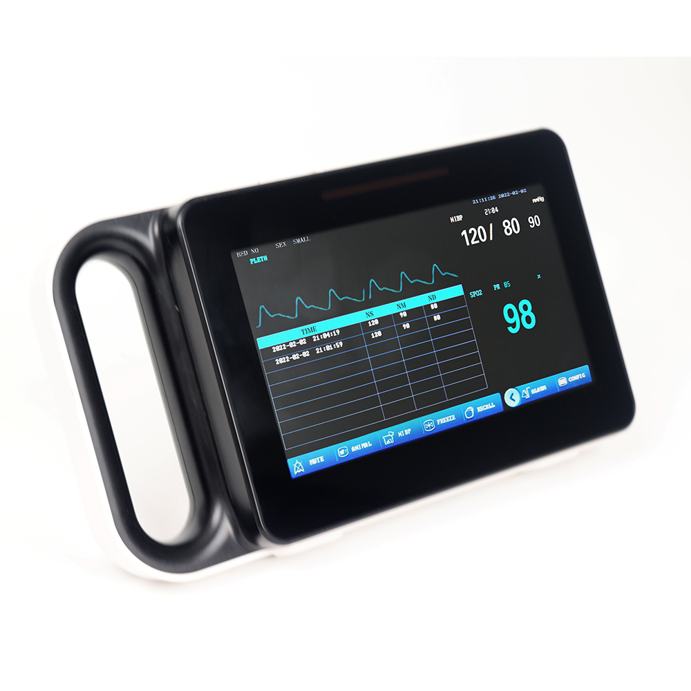 Yonker M7 Portable Patient Monitor 2 Yonker M7 Portable Patient Monitor - Image 2