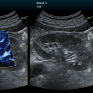 Yonker NEW Premium Diagnostic Ultrasound System Revo T2