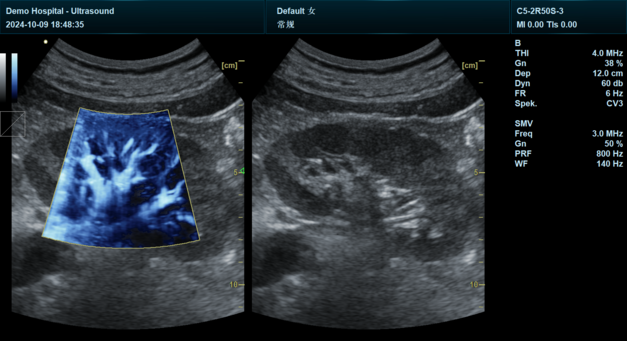 Yonker NEW Premium Diagnostic Ultrasound System Revo T2 12 Yonker NEW Premium Diagnostic Ultrasound System Revo T2 - Image 12