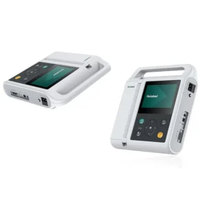Yonker ECG Monitor for Surgical Myocardial Ischemia Detection
