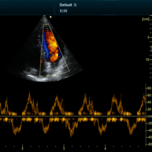 Yonker NEW Premium Diagnostic Ultrasound System Revo T2