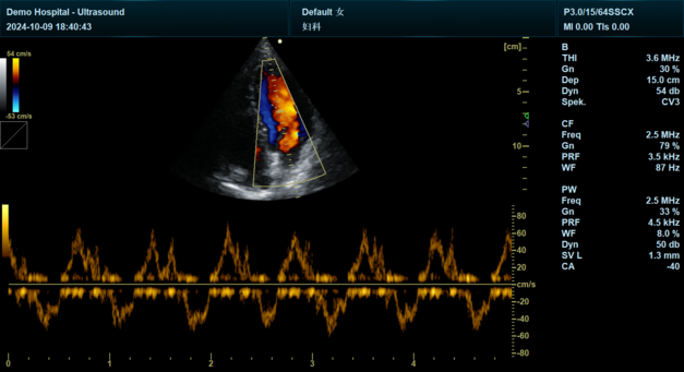 Yonker NEW Premium Diagnostic Ultrasound System Revo T2 11 Yonker NEW Premium Diagnostic Ultrasound System Revo T2 - Image 11