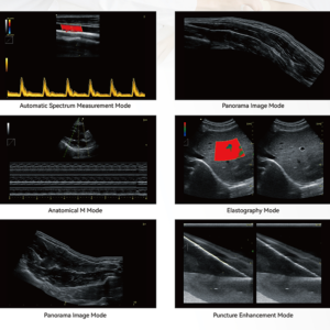 Yonker NEW Premium Diagnostic Ultrasound System Revo T1