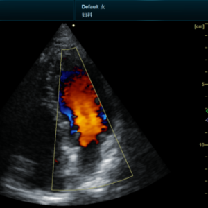 Yonker NEW Premium Diagnostic Ultrasound System Revo T2