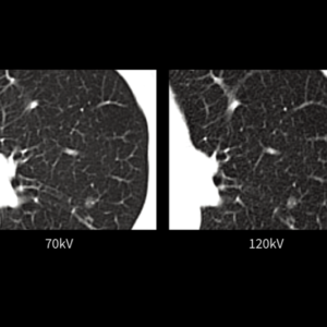 United Imaging uCT 528