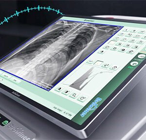Browiner MobileApex Series Redefining Intelligent Radiography