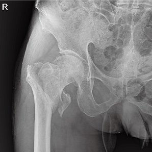 Browiner MobileApex Series Redefining Intelligent Radiography