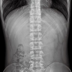 Browiner MobileApex Series Redefining Intelligent Radiography