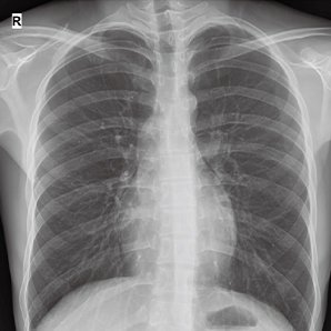 Browiner MobileApex Series Redefining Intelligent Radiography