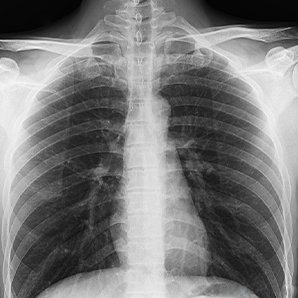 Browiner Beatle-06P3(Mi DR) Cost-effective Mobile X-ray System