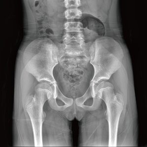 Browiner Highly Customizable Floor-mounted Radiography System