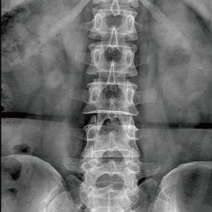 Browiner U-arm Radiography System