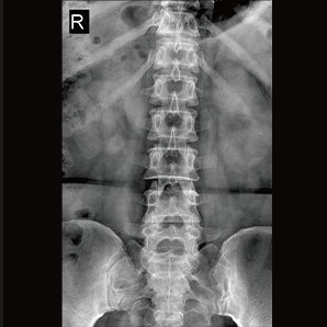 Browiner U-arm Radiography System