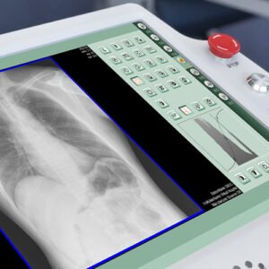 Browiner MobileSparkler Series Motorized Mobile X-ray System