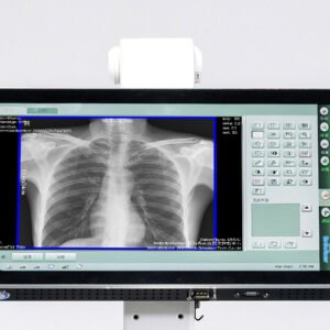 Browiner Beatle-06P3(Mi DR) Cost-effective Mobile X-ray System