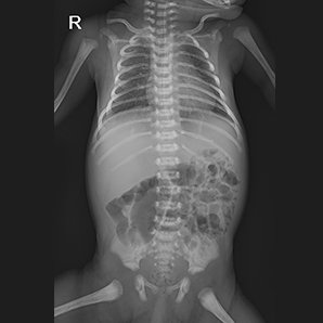 Browiner Beatle-06P(Neo DR) Pediatric X-ray imaging system
