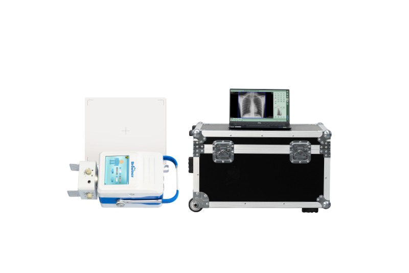 Browiner Portable X-ray System 2 Browiner Portable X-ray System - Image 2