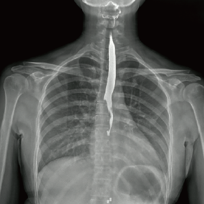Browiner PerfoX 7500 Multi-functional Digital X-ray System